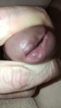 Is My Meatus Open?