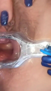 Masturbatie met baarmoederzicht en medische speculum, close-up van mijn poesje