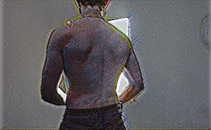 AlbinoAdonis: Strip prosím, série halation