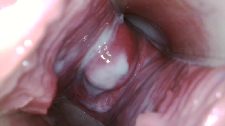 JANA studios: Endoscope in my pussy