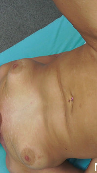 Nicole star fingert bei ihrer körperlichen untersuchung