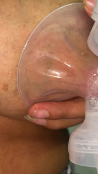 Solo Lactation Expression: High Volume Hand Extraction