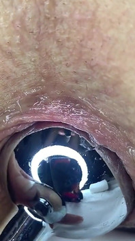 Inserarea dopului de fund de aproape