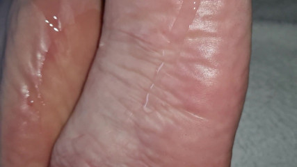 Alter: Caro foot.