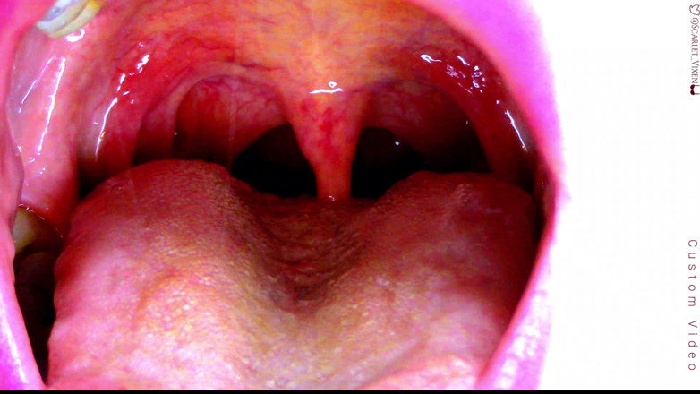 Scarlet Vixen: Sexy Scarlet zegt ahhhhhh - Uvula-show