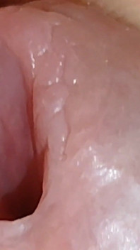 Amazing Glans with Two Cum Holes.