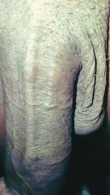 SolidmanGo: Blackdick