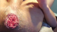 ANTHO St-Armand: Actualización de cogollos rosas