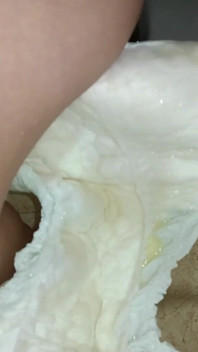 Sự tuyệt vọng