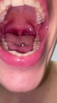 Mouth Tour No Makeup Teeth Tongue Uvula Tonsils Check