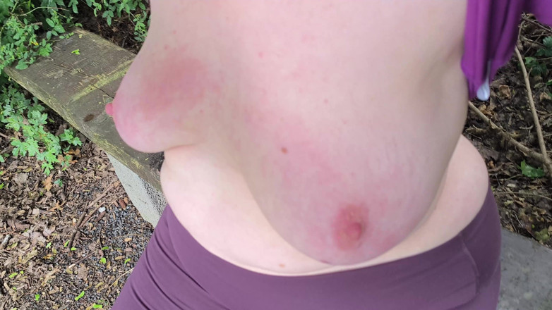 Bouncy Tits Action: Hard Titslapping Near the Pond