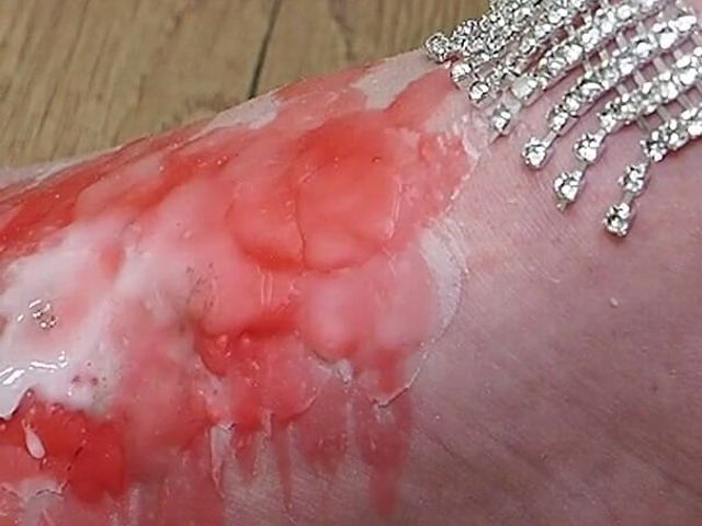 Fire of Hurt: Worship Through Wax (Anastasia Gree)