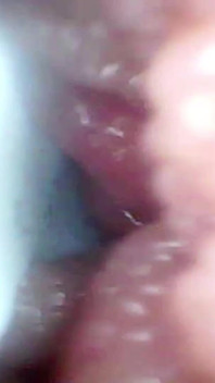 Kamera Endoskopi Merekam G Spot Istriku. Video edukatif close up