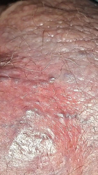 Nacktes Monster