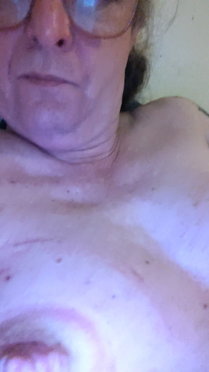 Alexia_mtf: 나를 자극하는 상처