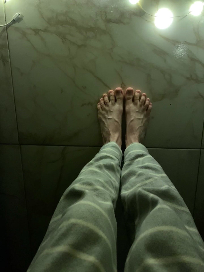 Princess Aisha: So Swollen Veins on the Feet