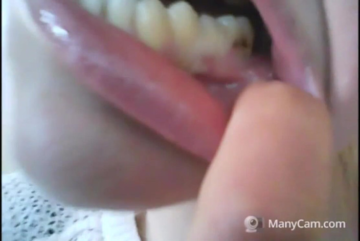 savannahamatoriale: Krásná tvář, ale zkažené zuby!