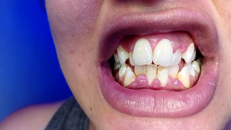 Elimoon: Чищу зуби і показую тобі мої зуби (крупним планом)