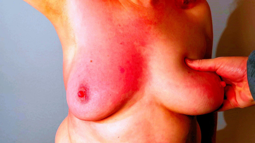 500 Strokes on Her Right Tit (DevoteTits - Extreme BDSM)