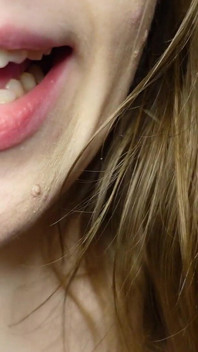 Je Te Parle Des Obturations Dans Mes Dents Et Des Visites Chez Les Dentistes
