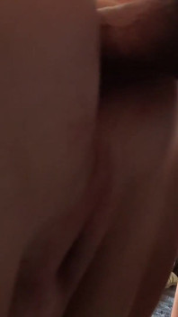 Anal Closeup