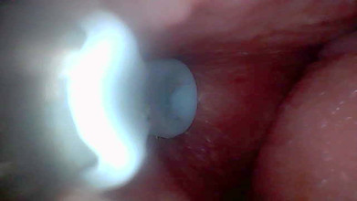 Twittiy: आइए एक साथ मेरी रसदार चूत में झांकें (एंडोस्कोप कैमरा)