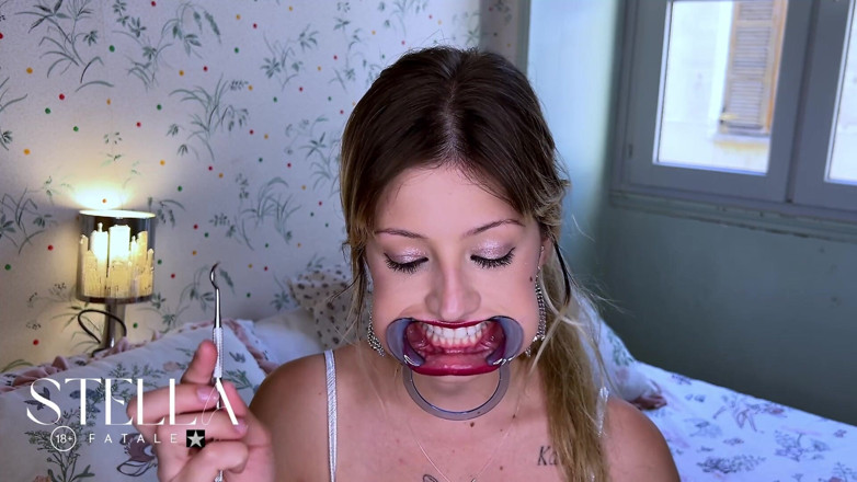 Stellafatale: Dental Tools Mouth Exam All Teeth Displayed