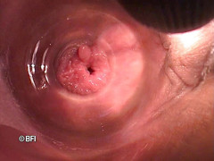 Pegging insertion: Bizarní soubory 162