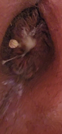 Huge Asspussy Gape with Help From 9.5 in. Circumference King Cock Chubby!