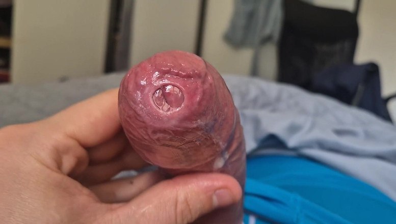 GloomyChase977: Phimosis 자지 precum 드립 클로즈업