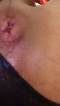 My Little Ass Hole