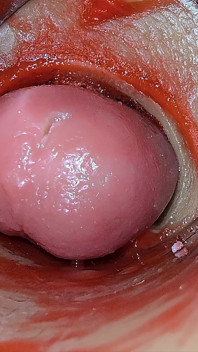 Kamera Uvnitř Hluboké Kundičky Zachycuje Předávkování Ejakulace Spermatu Asmr