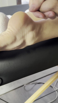 The Lollipop Couldn’t Handle the Pressure