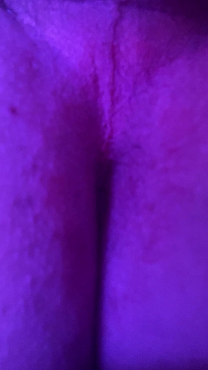 Solodu35x: Small Pink Hole