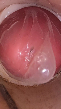La caméra dans la chatte profonde filme une énorme éjaculation de sperme dans le préservatif