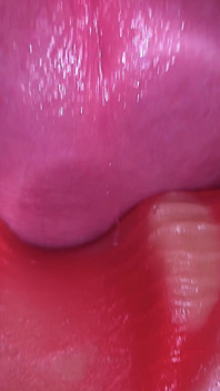 Super semen en la vagina. Excelente cámara interna