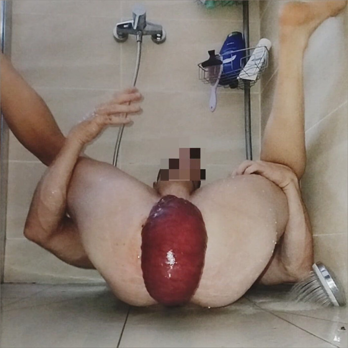 Maganafolgas: 大型ケース