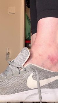 Size 16 Feet Squeezing Into Smaller Size Sneakers