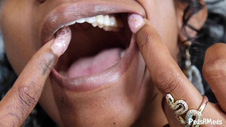 PedsRMeds: Chuyến tham quan Phoenix Mouth duy nhất của bạn