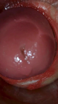 Derin amcık içindeki kamera sperm asmr'nin büyük boşalmasını yakalıyor