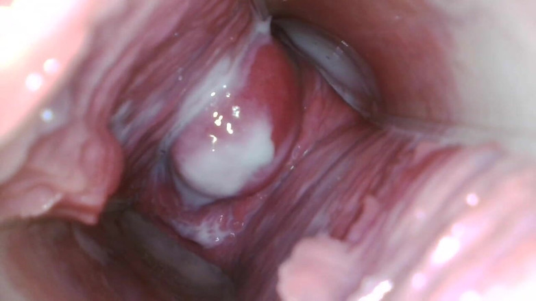 JANA studios: Endoscope in my pussy
