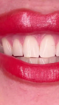 Red Lips