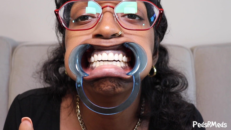 PedsRMeds: Youronlyphoenix - recorrido boca retractor dental