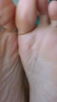 แกล้งโง่เพื่อเท้า