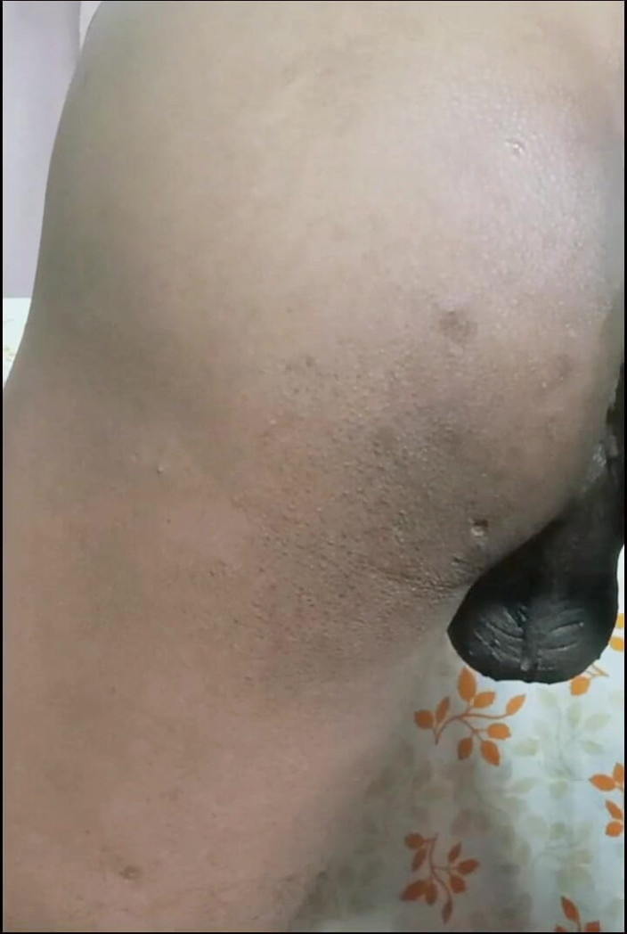 Kamu: 大屁股