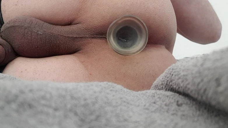 BiCgn: Placer anal