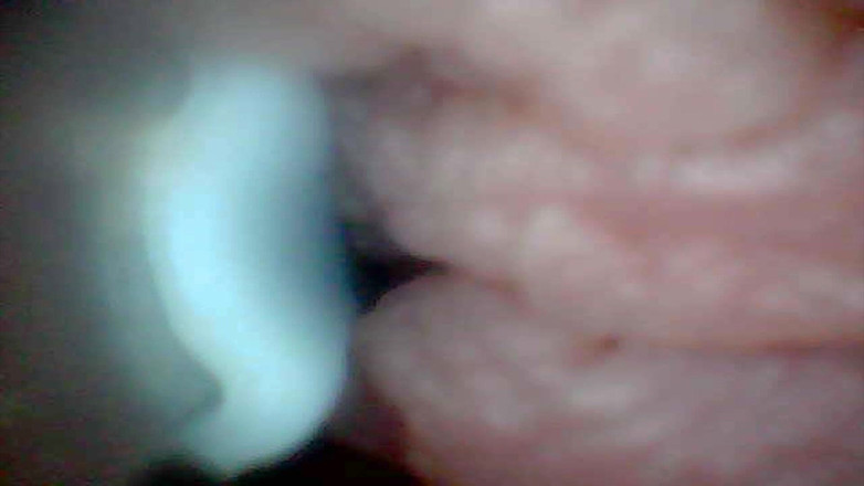 Twittiy: Echemos Un Vistazo a Mi Jugoso Coño Juntos (cámara De Endoscopio)