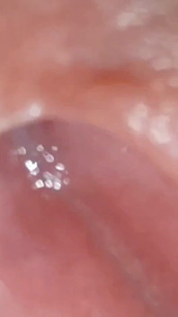 Amazing Glans with Two Cum Holes.