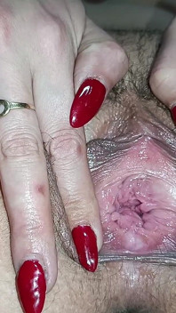 Gynecologist Close-up