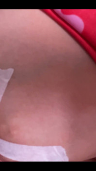 My Boob Is About to Explode